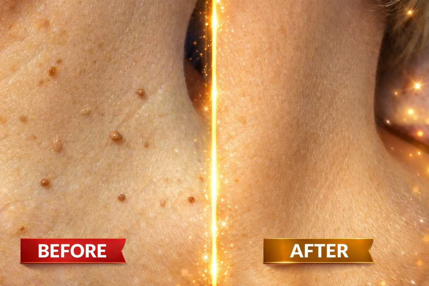 DermaSmooth - Skin Tags & Pimple Removal PATCH (Buy 36 Get 36 Free)