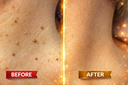 DermaSmooth - Skin Tags & Pimple Removal PATCH (Buy 36 Get 36 Free)