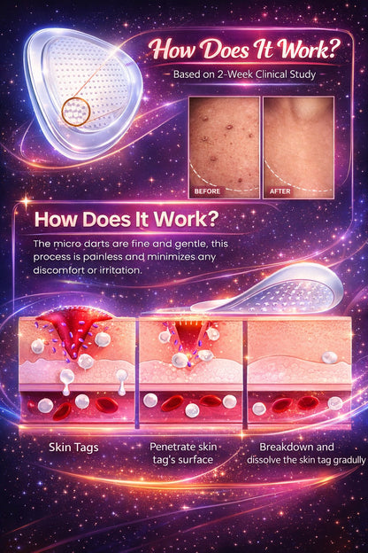DermaSmooth - Skin Tags & Pimple Removal PATCH (Buy 36 Get 36 Free)